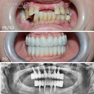 lek. dent. Piotr Jaszcz, Chirurg stomatologiczny, Implantolog, Periodontolog